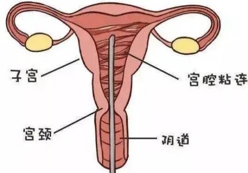 杭州代怀服务：﻿2022hcg翻倍孕酮却降低会有什么样的后果?